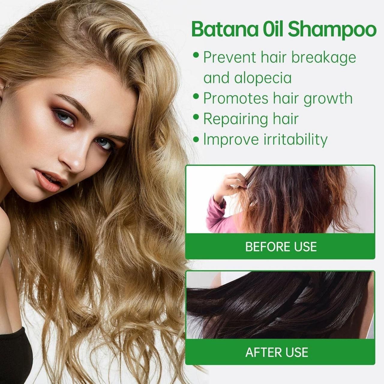 TryOnes BATANA OIL SHAMPOO with Rosemary Extract 400 ml Pack of 2