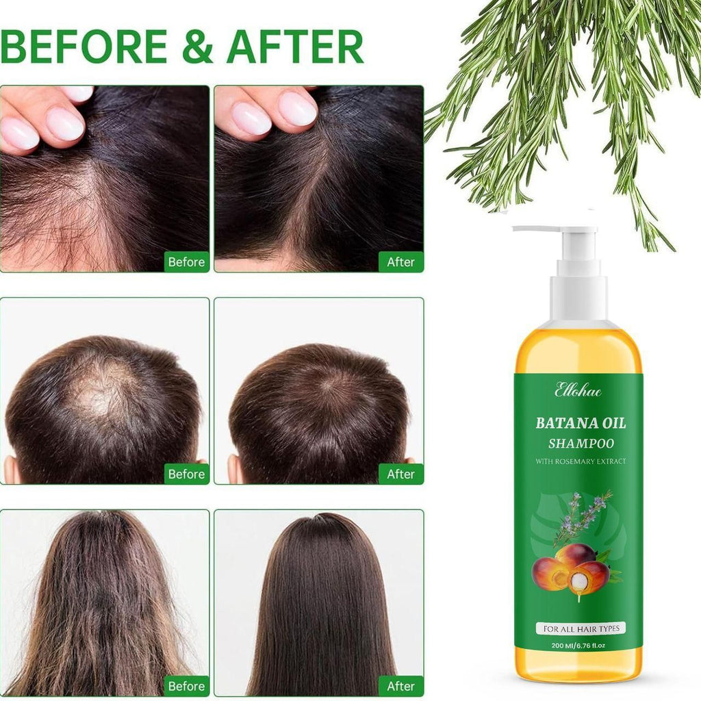 TryOnes BATANA OIL SHAMPOO with Rosemary Extract 400 ml Pack of 2